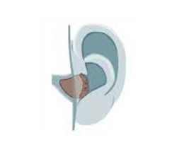image-145539-ear2.jpg?1432541789029