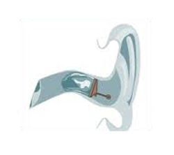 image-145538-ear1.jpg?1432541773453