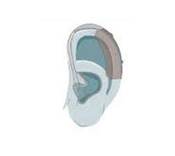 image-145540-ear3.jpg?1432541802039